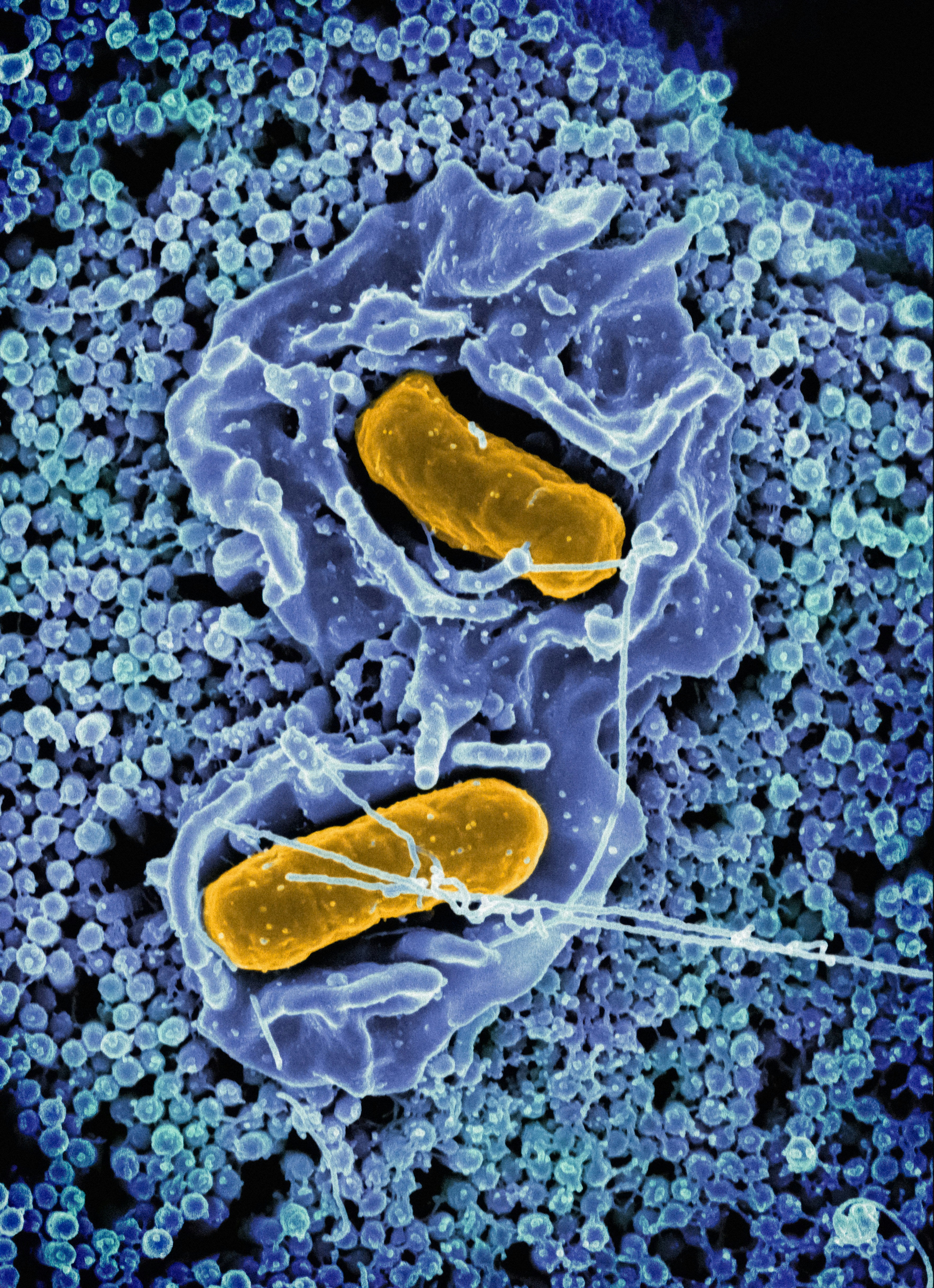 Explorando nuestro segundo cerebro: La vital importancia de los microbios intestinales